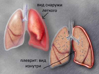 Очень болит правый бок и отдает в спину