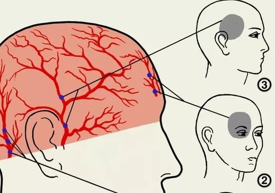 Болят глазницы и голова причины