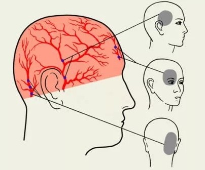 Часто болит голова в области затылка ближе к шеи
