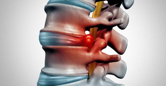 болит спина даже утром