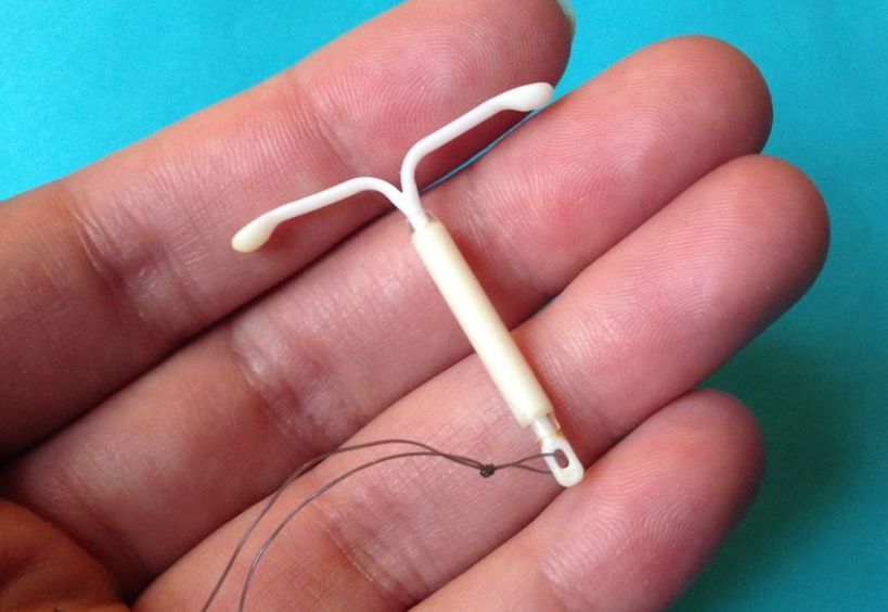 Спираль Мирена