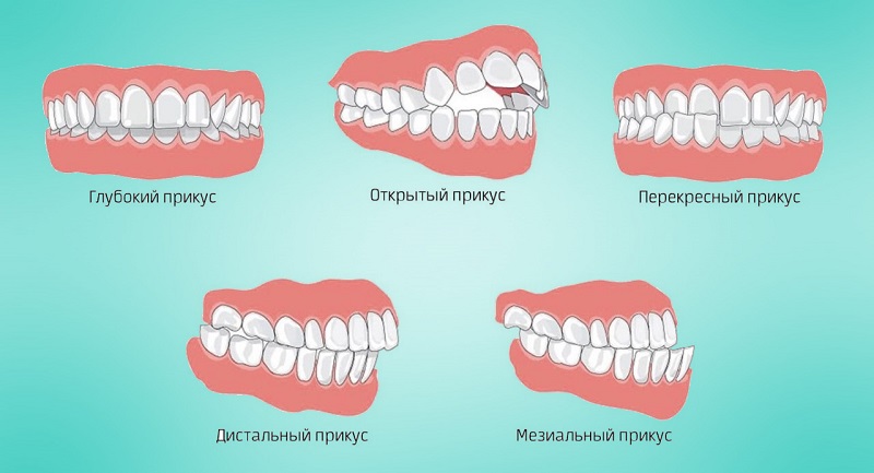болит спина и зубы