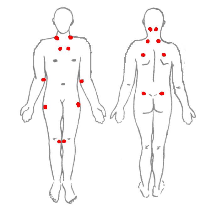 Почему болят рёбра спереди и сзади6