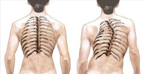 Болит спина если работать в наклон