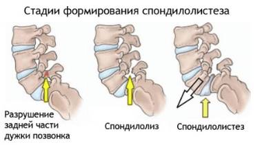 болит спина позвоночник ночью