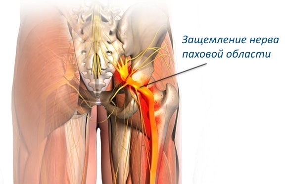 Болит левая нижняя часть спины у мужчины