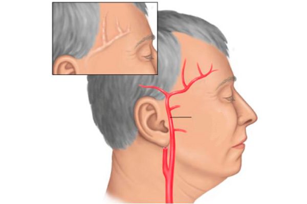 болит голова в районе лба и не помогают таблетки