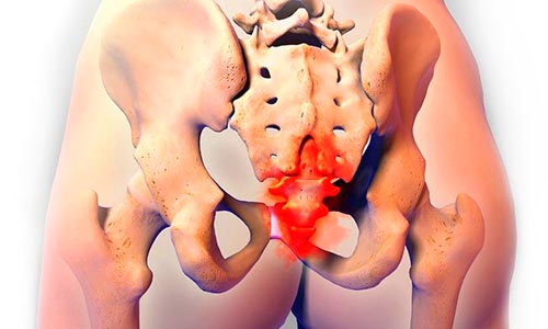 Болит спина в области копчика больно сидеть