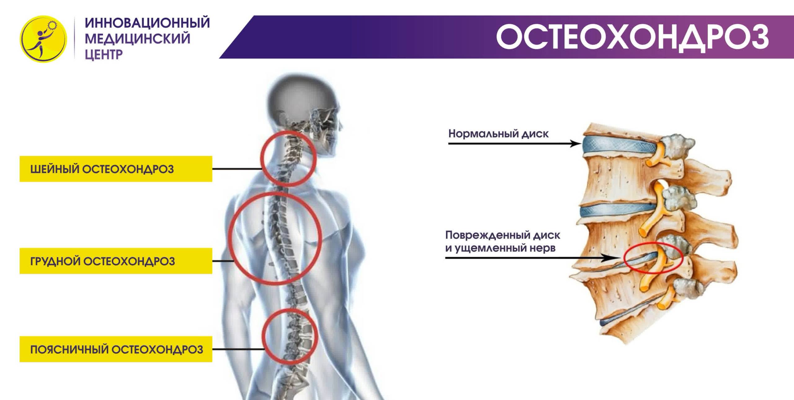 Когда делаю отжимания болит спина