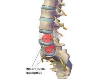 В положении стоя начинает болеть спина