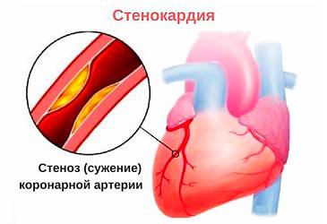 Болит очень спина больно дышать что может быть