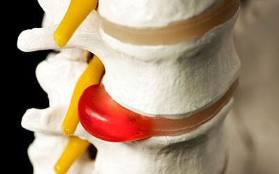 болит спина позвоночник ночью