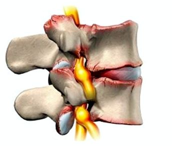 болит спина позвоночник ночью