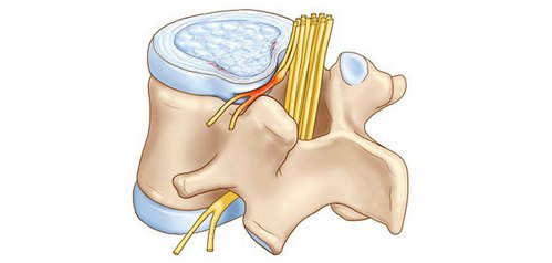 почему при приседаниях болит спина