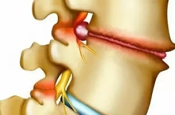 При наклоне головы болит позвоночник