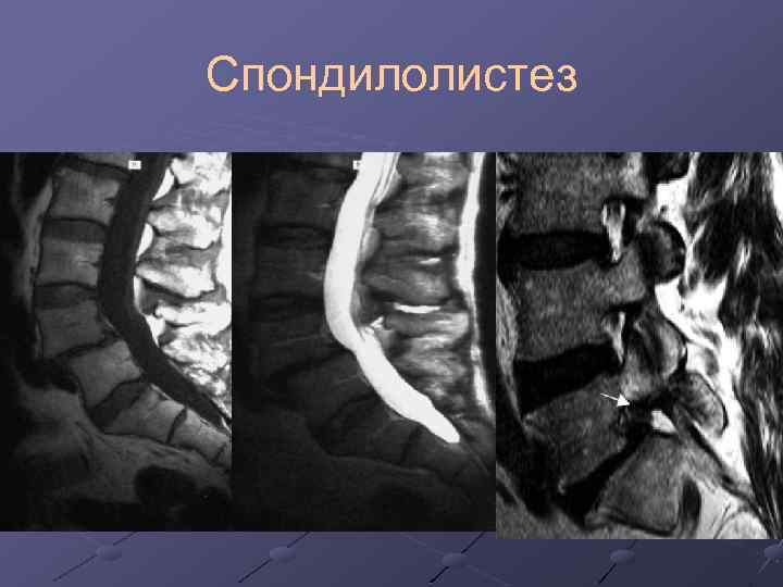 Болит спина в области копчика больно сидеть