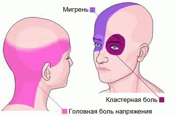 болит голова в районе лба и не помогают таблетки