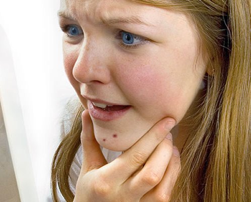 Появилась простуда на бороде